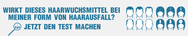 Bild Haarausfall Test